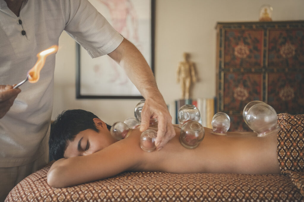 Wellness Sanctuary -Cupping